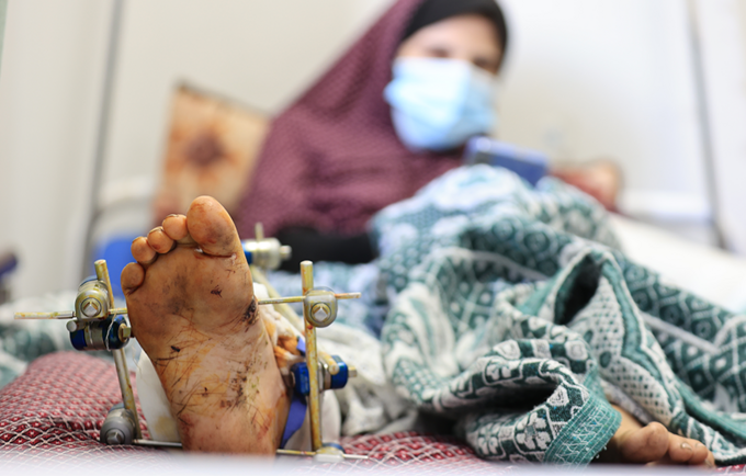 26歳のソンドスさんは、妊娠中に爆発に巻き込まれた。彼女は負傷した足と手の手術を受け、アル・ヒロ病院で緊急帝王切開の末、出産した。