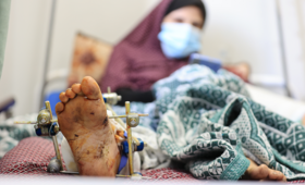 26歳のソンドスさんは、妊娠中に爆発に巻き込まれた。彼女は負傷した足と手の手術を受け、アル・ヒロ病院で緊急帝王切開の末、出産した。